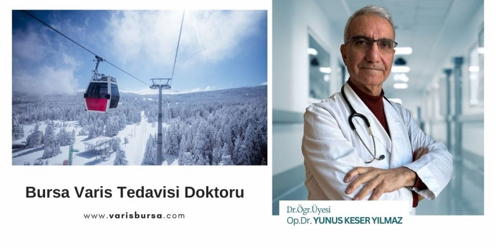 Bursa Varis Tedavisi Doktoru