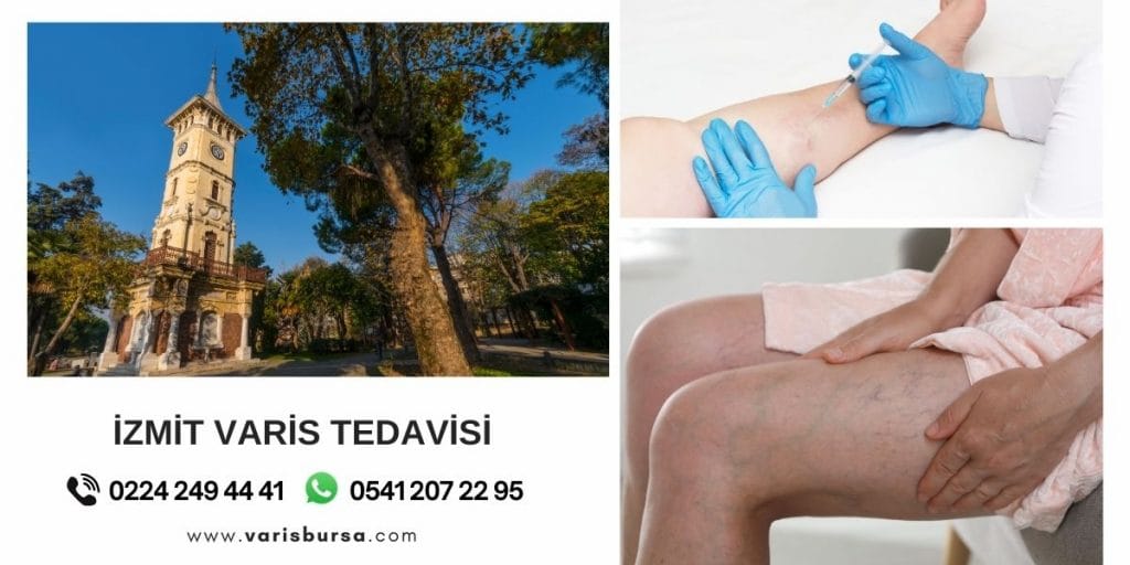 İzmit Varis Tedavisi