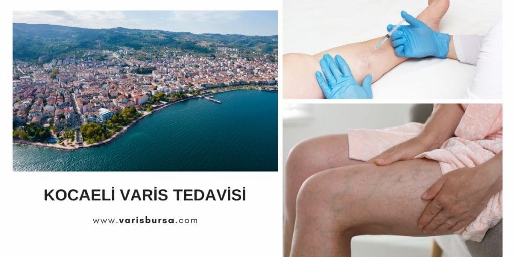 Kocaeli varis tedavi